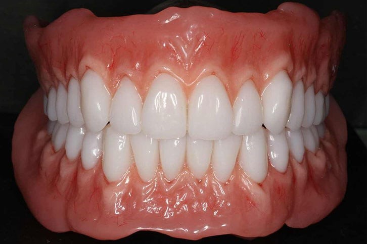 Eating With Partial Dentures Houston TX 77072